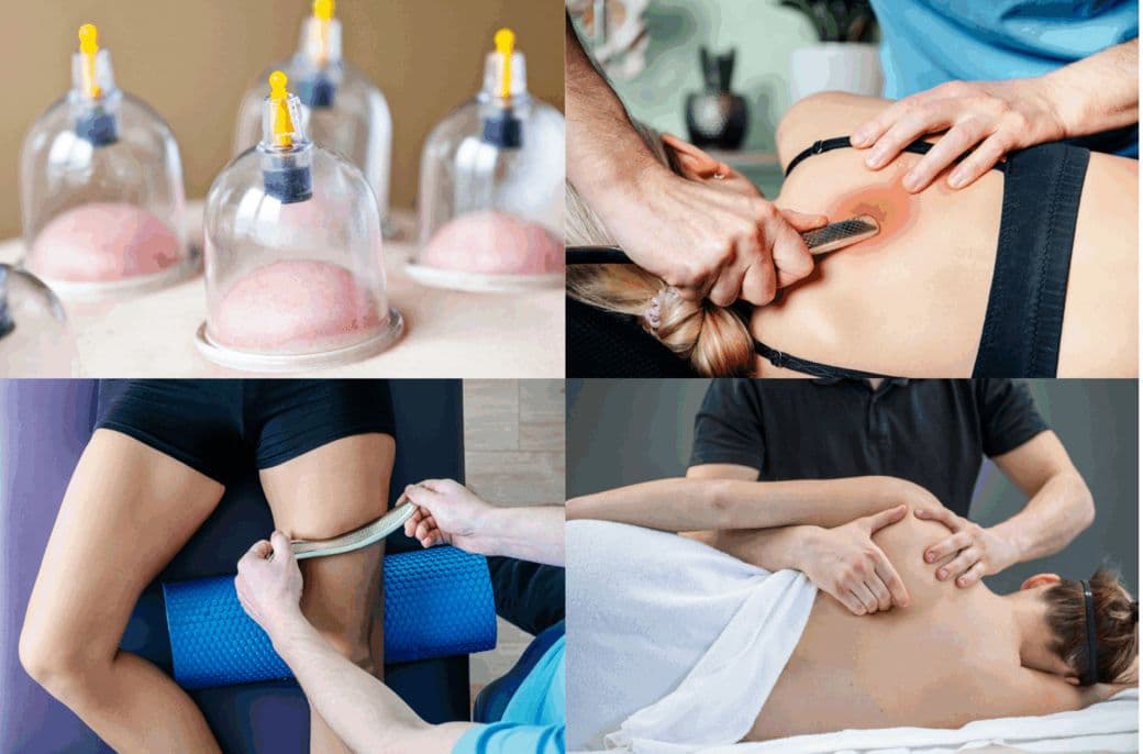 Recovery Regenerativo